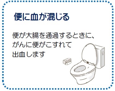 便に血が混じる 便が大腸を通過するときに、がんに便がこすれて出血します